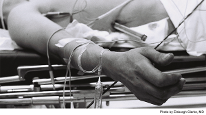 Guidelines On Administering Sedation to Patients Unnecessarily Restrictive for ED Physicians