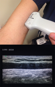 Figure 8. Long-axis positioning.