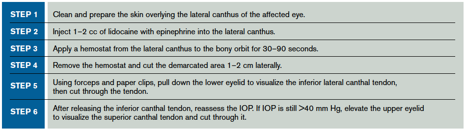 Table 2. Lateral Canthotomy & Cantholysis Procedure Steps