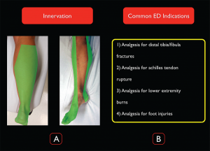 How to Perform Ultrasound-Guided Distal Sciatic Nerve ... muscle tendon diagram 