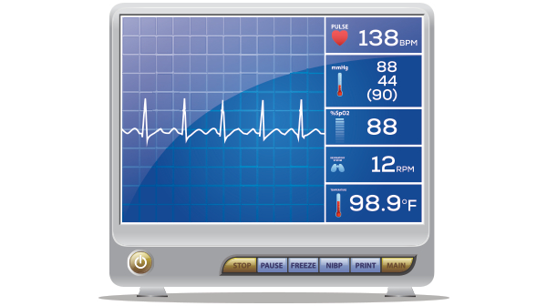 Timing Resuscitation Sequence Intubation for Critically Ill Patients