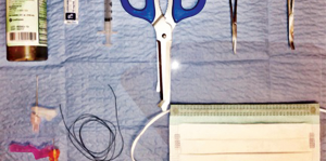 Emergency Medicine Techniques, Equipment List for Removing Fishhooks Lodged in Patients