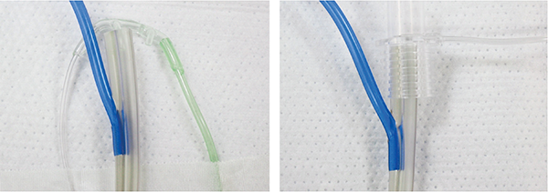 Figure 1. Placement of a Side-Stream Capnometer (left) and Mainstream Capnometer (right)