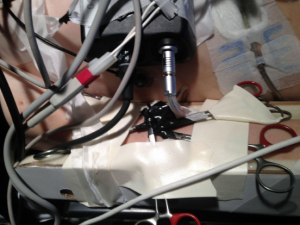 Figure 1: Successfully reconnected LVAD battery pack. Each cut wire was spliced back together, allowing the LVAD to restart. 