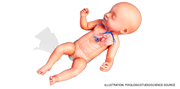 congenital heart disease