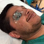Figure 3: Place a Tegaderm film dressing over the patient’s closed eye, gently press out any pockets of air, and apply a copious amount of gel directly over the Tegaderm.