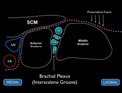 Figure 3 Schematic representation of the interscalene brachial plexus. Note the prevertebral fascia located above the middle and anterior scalene muscles. 