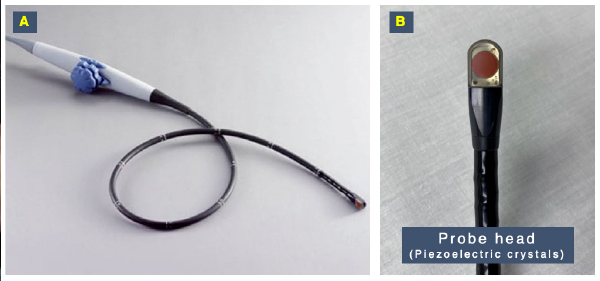 Figure 1: TEE probe (A) includes a controller with two wheels and two lateral buttons, an endoscopic shaft, and a probe head (B). The probe head houses the piezoelectric crystals that generate the ultrasound beam.