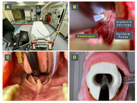 Figure 4: Probe insertion technique. (A) The TEE probe handle should be hung or held by an assistant to allow free movement of the shaft. (B) The probe should be inserted maintaining midline to avoid common sites of obstruction at the arytenoid cartilages and pyriform fossae. (C) Once at the base of the tongue at midline, a “chin lift” maneuver will facilitate passage by opening the esophagus. (D) Once in place, a bite block previously loaded into the probe should be placed to avoid damage by the teeth on the probe.