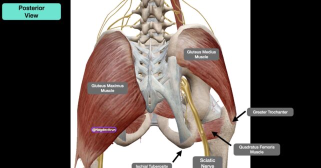 How To Relieve Sciatica Pain with New TransGluteal Nerve Block Treatment -  ACEP Now