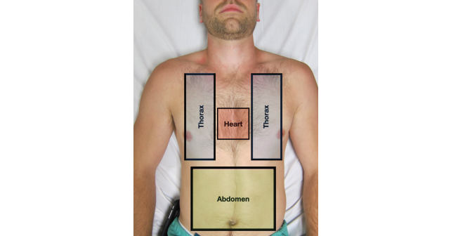 eFAST 2.0: Refining an Integral Trauma Exam - ACEP Now